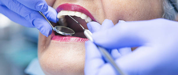 Best Emergency Dental Care for Broken or Chipped Teeth in Red Lion, PA