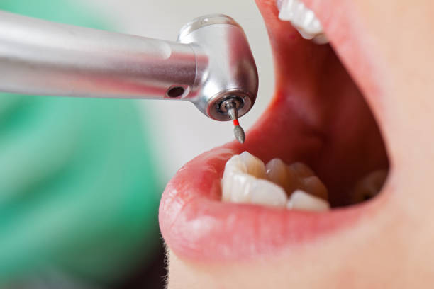 Best Emergency Gum Treatment in Red Lion, PA